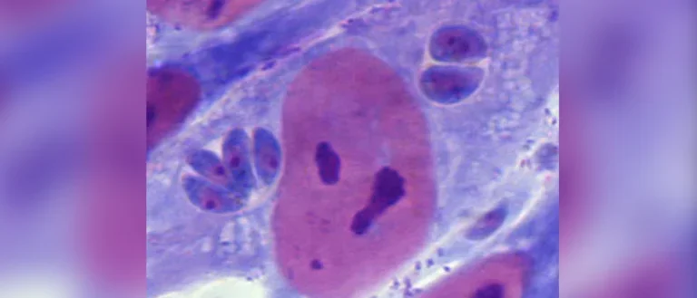 Two toxoplasma vacuoles residing inside a human host cell. Also shown is the human host cell nucleus.