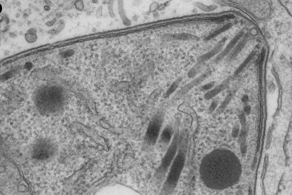 Electron Microscopy image of a single Toxoplasma cell focused on the apical cap region of the parasite. The parasite's rhoptries are clearly visible.