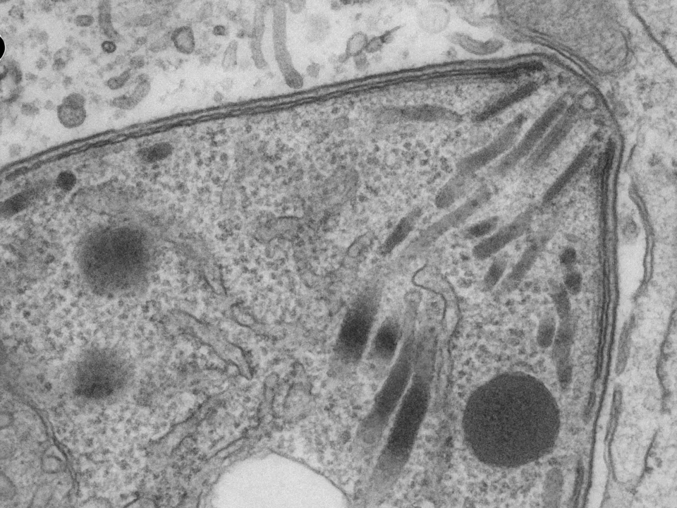 Electron Microscopy image of a single Toxoplasma cell focused on the apical cap region of the parasite. The parasite's rhoptries are clearly visible.